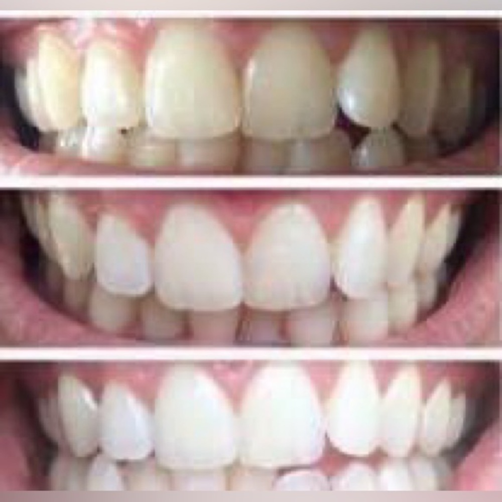 AP24 Whitening Toothpaste - Picture 5 of 7